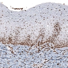 Immunohistochemical staining of human cervix shows moderate to strong nuclear positivity in epithelial and connective tissue cells.