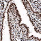 Anti-HIST1H2BC Antibody