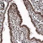 Immunohistochemical staining of human fallopian tube shows strong nuclear immunoreactivity in glandular and stromal cells.