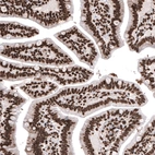 Immunohistochemical staining of human duodenum shows strong nuclear positivity in glandular cells and in lamina propria cells.