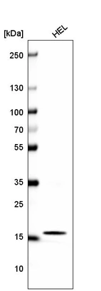 Western blot analysis in human cell line HEL.