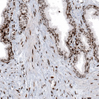 Anti-HIST1H2BC Antibody