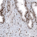 Immunohistochemical staining of human prostate shows moderate to strong nuclear positivity in glandular and smooth muscle cells.