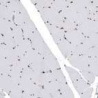 Immunohistochemical staining of human striated muscle shows strong nuclear positivity in striated muscle fibers.