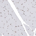 Immunohistochemical staining of human striated muscle shows strong nuclear positivity in striated muscle fibers.