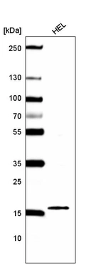 Western blot analysis in human cell line HEL.