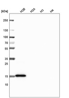 Western blot analysis of purified human recombinant histone H2B, H2A, H3 and H4.