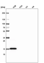 Western blot analysis of purified human recombinant histone H2B, H2A, H3 and H4.