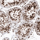 Immunohistochemical staining of human testis shows strong nuclear positivity in cells in seminiferous tubules.