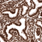 Immunohistochemical staining of human endometrium shows strong nuclear immunoreactivity in glandular and stromal cells.