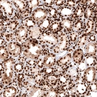 Immunohistochemical staining of human kidney shows strong nuclear positivity in renal tubules cells.