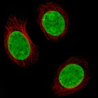 Immunofluorescence staining of MCF7 cells using the Anti-H2AFX monoclonal antibody, showing specific staining in nucleoplasm and nucleoli in green. Microtubule- and nuclear probes are visualized in red and blue, respectively (where available).
