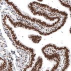 Immunohistochemical staining of human fallopian tube shows strong nuclear positivity in glandular and stromal cells.