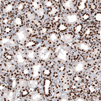 Anti-H2AFY Antibody