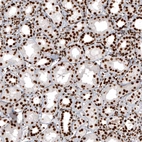 Immunohistochemical staining of human kidney shows strong nuclear positivity in renal tubules cells.