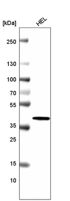 Western blot analysis in human cell line HEL.