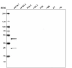 Western blot analysis of purified human recombinant histone mH2A.1, mH2A.2, H2A.X, H2A.Z, H2A, H2B, H3 and H4.