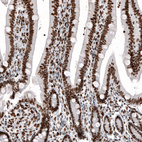 Anti-H2AFY Antibody