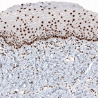 Immunohistochemical staining of human cervix shows strong nuclear positivity in squamous epithelial cells and in connective tissue cells.