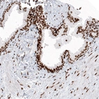 Immunohistochemical staining of human prostate shows strong nuclear immunoreactivity in glandular and smooth muscle cells.
