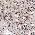 Immunohistochemical staining of human kidney shows strong nuclear positivity in renal glomeruli and renal tubules cells.
