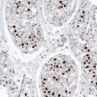 Anti-H2AFY2 Antibody