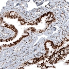 Immunohistochemical staining of human fallopian tube shows strong nuclear immunoreactivity in glandular cells and moderate positivity in stromal cells.