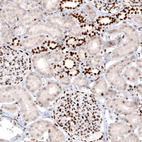 Anti-H2AFY2 Antibody