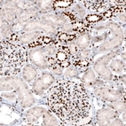 Immunohistochemical staining of human kidney shows strong nuclear positivity in cells in renal glomeruli and a subset of renal tubules.