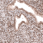 Immunohistochemical staining of human endometrium shows moderate to strong nuclear positivity in glandular and stromal cells.