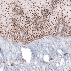 Immunohistochemical staining of human uterine cervix shows strong nuclear positivity in epithelial cells.