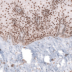 Anti-CUX1 Antibody