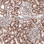 Immunohistochemical staining of human kidney shows strong nuclear positivity in cells in glomeruli.