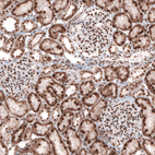 Anti-CUX1 Antibody