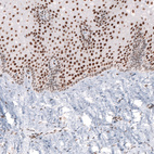 Anti-CUX1 Antibody