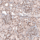 Anti-CUX1 Antibody