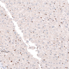 Anti-CUX1 Antibody