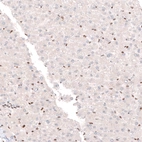 Immunohistochemical staining of human liver shows moderate nuclear positivity in leukocytes and no positivity in hepatocytes.