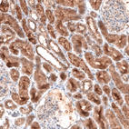 Anti-LAPTM4B Antibody