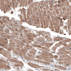 Anti-LAPTM4B Antibody