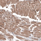 Immunohistochemical staining of human heart muscle shows moderate cytoplasmic immunoreactivity in cardiomyocytes.