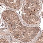 Immunohistochemical staining of human testis shows moderate cytoplasmic immunoreactivity in seminiferous tubules cells.