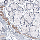 Immunohistochemical staining of human salivary gland shows absence of positivity in glandular cells as expected (negative control), while skeletal muscle fibers are positive.