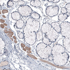 Anti-LAPTM4B Antibody