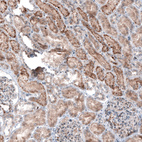 Anti-LAPTM4B Antibody