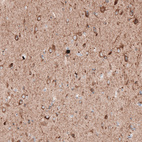 Anti-LAPTM4B Antibody