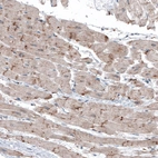 Immunohistochemical staining of human heart muscle shows moderate granular cytoplasmic positivity in cardiomyocytes.