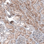 Immunohistochemical staining of human kidney shows moderate to strong granular cytoplasmic positivity in cells in tubules.