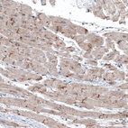 Anti-LAPTM4B Antibody