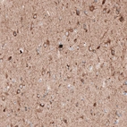Immunohistochemical staining of human cerebral cortex shows moderate to strong granular cytoplasmic positivity in neurons.